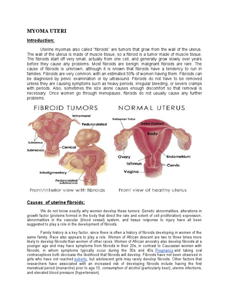 Myoma Uteri: Pregnancy Puberty | PDF | Uterus | Women's Health