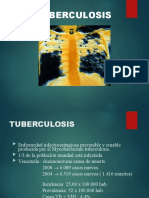 TUBERCULOSIS M