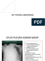 Thorax Abnormal