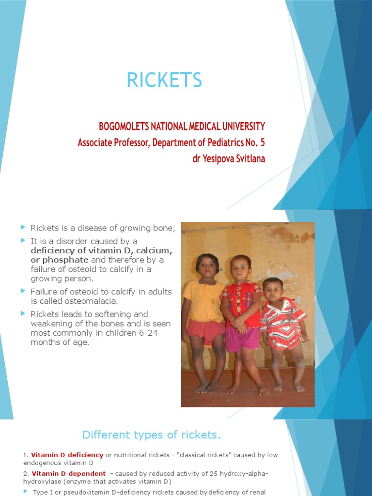 1 Rickets | PDF | Vitamin D | Clinical Medicine