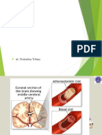 Stroke Presentasi