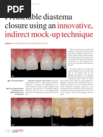 Preventive Resin Restorations Guide | PDF | Dentistry Branches | Dentistry