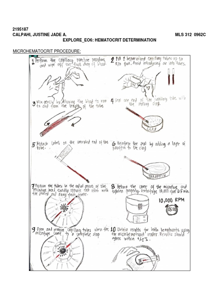 Microhematocrit Tube Drawing