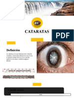 Cataratas: clasificación, síntomas y tratamiento quirúrgico