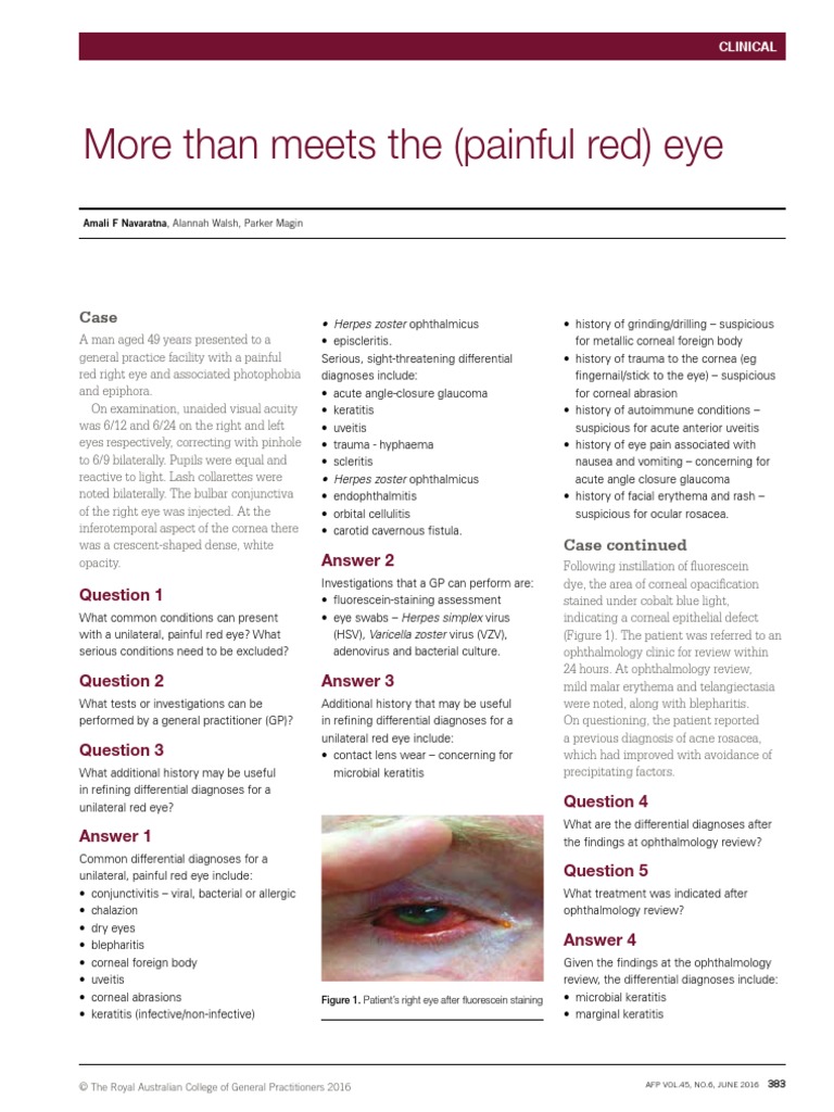 More Than Meets The (Painful Red) Eye: Answer 2 | PDF | Ophthalmology ...
