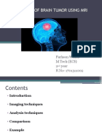 Detection of Brain Tumor Using Mri Images: Farheen Wahab M.Tech (ECS) 2 Year R No-1701311002