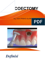 Apicoectomy 2