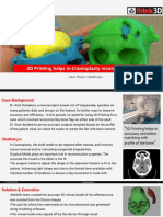 3D Printing Helps in Cranioplasty Reconstruction: Case Study - Healthcare