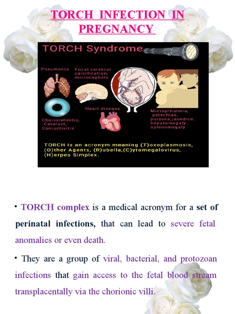 Torch Infections PDF Herpes Simplex Pregnancy
