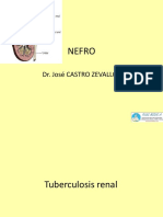 TBC Renal A Base de Preguntas