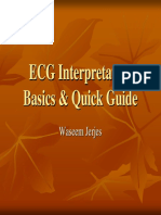 ECG Interpretation ECG Interpretation Basics & Quick Guide ( PDFDrive )