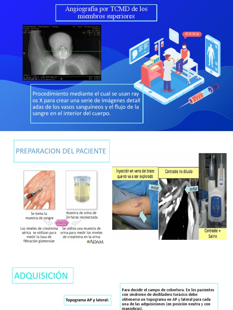Angiocat Miembro Superior | PDF | Ciencia y matemáticas | Informática