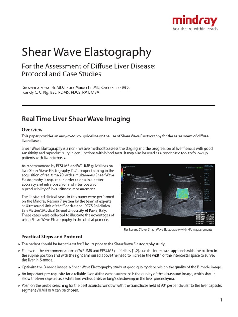 Shear Wave Elastography | PDF | Cirrhosis | Medical Ultrasound