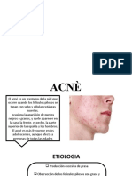 Acne