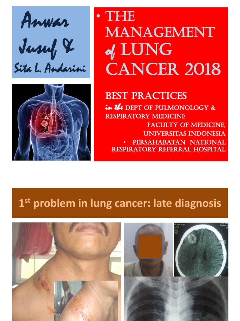 Lung Cancer Management Best Practices | PDF | Non Small Cell Lung ...