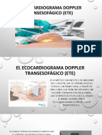 El Ecocardiograma Doppler Transesofágico (ETE)