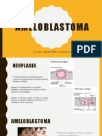 Ameloblastoma