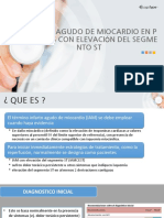 Infarto Agudo de Miocardio en P Acientes Con Elevación Del Segme Nto ST