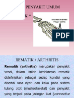 Remathoid