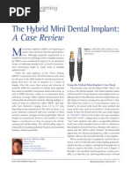 Download Product Focus The Hybrid Mini Dental Implant A Case Review by DentalLearning SN49471969 doc pdf