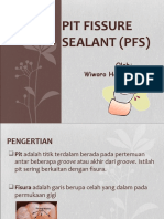 PIT FISSURE SEALANT (PFS): PENCEGAHAN KARIES PRIMER