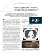 First Case of Combined Small-Cell Lung Cancer With ELM4-ALK Fusion