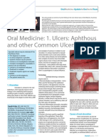 Oral Ulcers 1