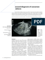 Ultrasound Diagnosis of Caesarean Scar Defects