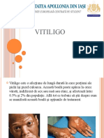 Vitiligo