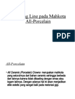 Finishing Line Pada Mahkota All-Porselain