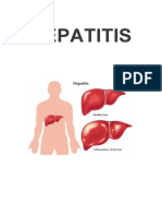 Hepatitis Bu Ebi