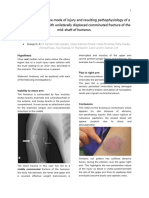 Investigating humerus fracture pathophysiology