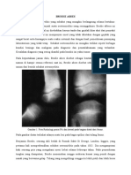 Osteomyelitis Brodie Abses