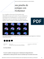 Prueba de Sangre Diagnostica El Alzheimer