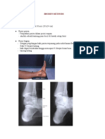 Broden Methods