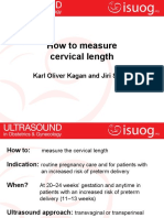 How To Measure Cervical Length: Karl Oliver Kagan and Jiri Sonek
