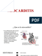 MIOCARDITIS