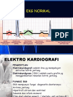 EKG Normal Edi