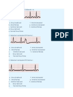 Soal Ekg Lagi