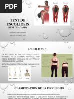 Test de Adams para detectar escoliosis | PDF | Escoliosis ...