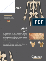 Exposicion Osteoporosis-Final