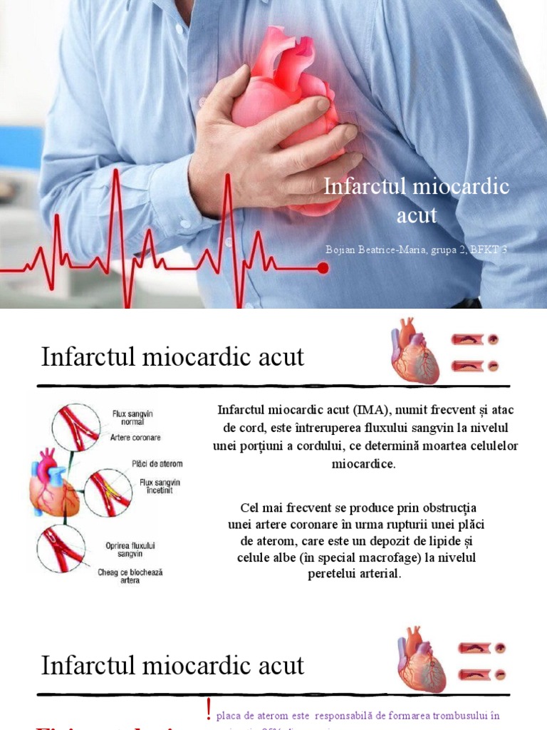 Infarctul Miocardic Acut | PDF