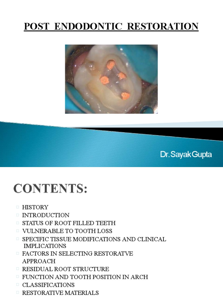 Restoration of Endodontically Treated Teeth | PDF | Dental Composite ...