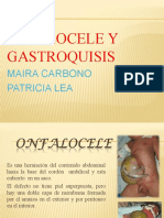 Onfalocele y gastrosquisis: tratamiento quirúrgico