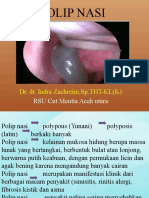 11.polip Nasi