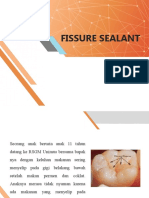 Fissure Sealant