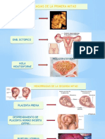 Hemorragias de la primera mitad del embarazo