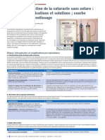 Extraction de La Cataracte Sans Suture Complications Et Solutions