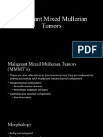 Malignant Mixed Mullerian Tumors