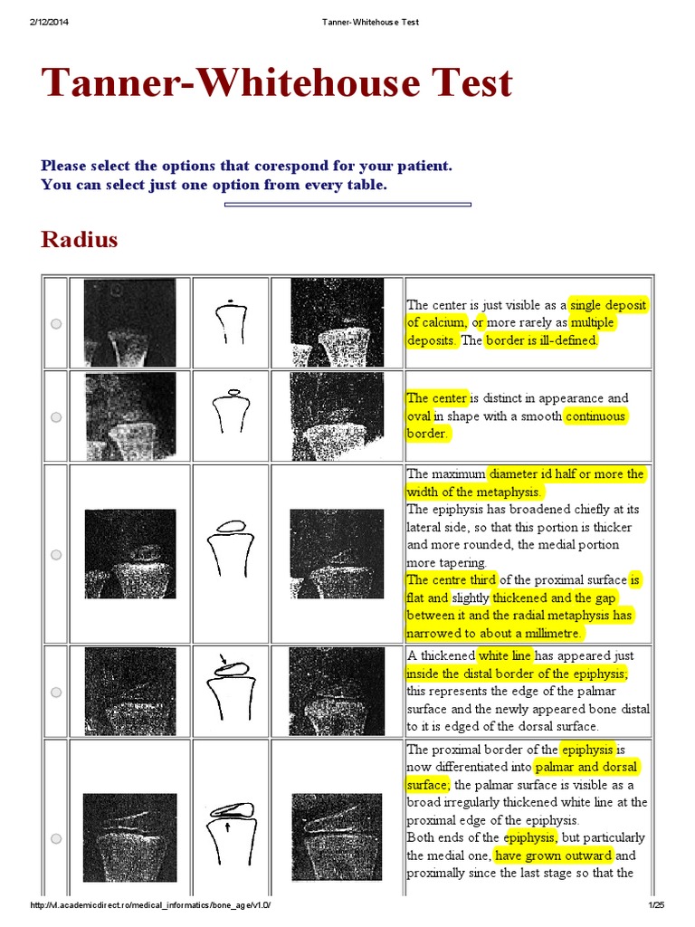 Tanner Whitehouse Test | PDF | Anatomical Terms Of Location | Hand